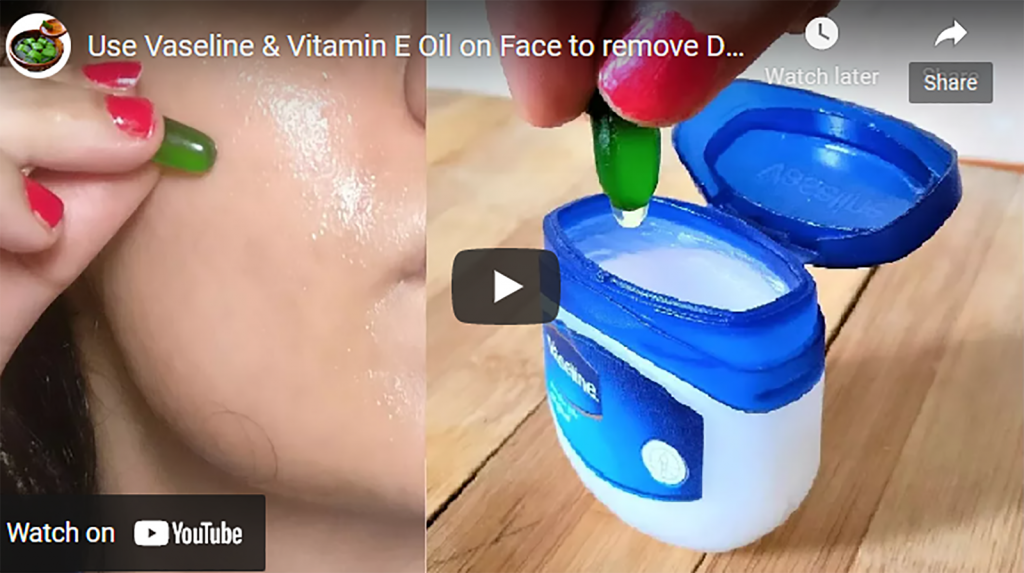 How To Use Vaseline & Vitamin E Oil On Your Face To Remove Dark Spots